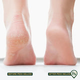 Pedi Deluxe