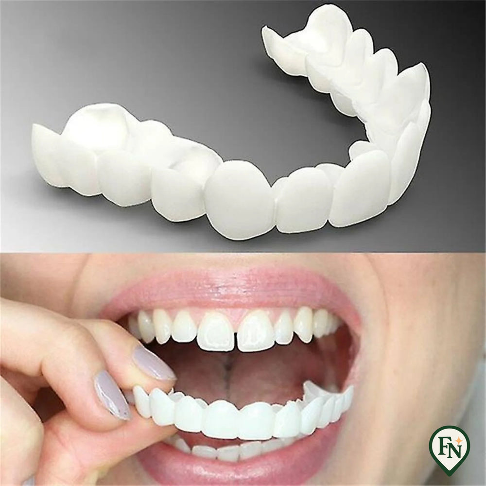 Perfect-Smile Boven & Onder