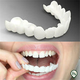 Perfect-Smile Boven & Onder
