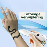 Spot VerwijderingsPen