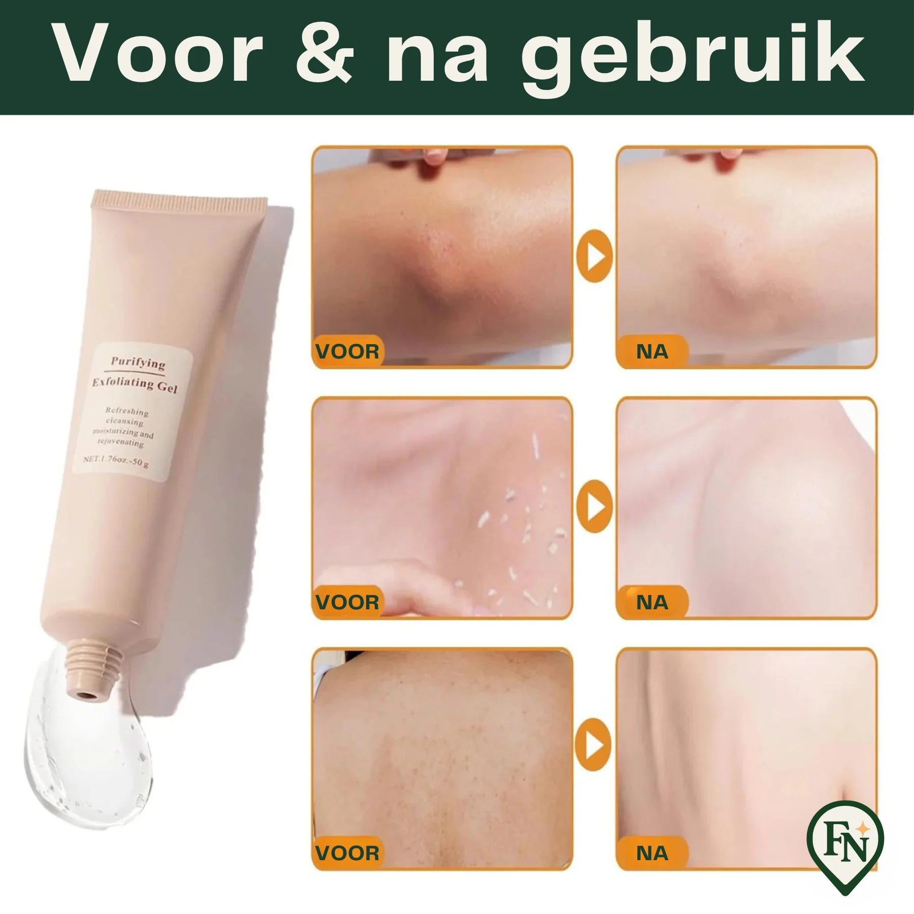Zuiverende Exfoliatie-Gel
